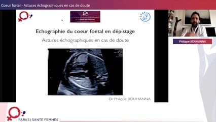 Cœur Fœtal en dépistage: Astuces en cas de doute