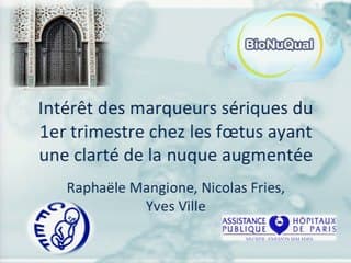 Intérêt des marqueurs sériques du 1er trimestre chez les foetus présentant une hyperclarté nucale