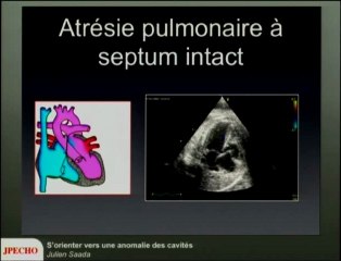 S’orienter vers une anomalie des cavités