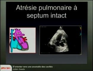 S’orienter vers une anomalie des cavités