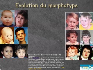Syndrome d’Emanuel