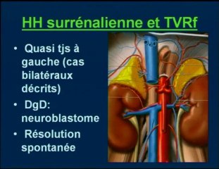 Atteintes vasculaires du rein foetal