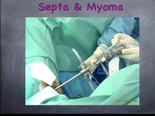 Imagerie des myomes:Cas clinique & synthèse