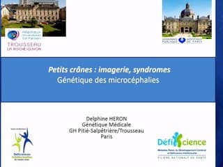 Petits crânes :syndromes*