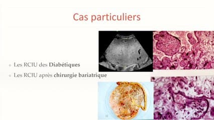 Des maladies chroniques maternelles aux images foetales