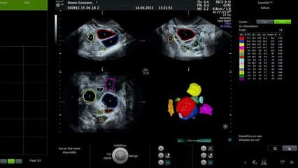 Démonstration live : monitorage de l’ovulation
