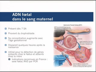 DPNI : que dire aux patientes ?