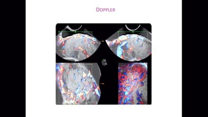 Placenta et cordon : quand s’en préoccuper