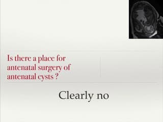 la chirurgie in utero, en développement ou en sursis ? Les kystes cérébraux