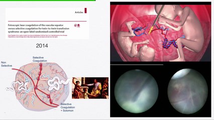Les 10 publications marquantes en médecine fœtale (hors imagerie)