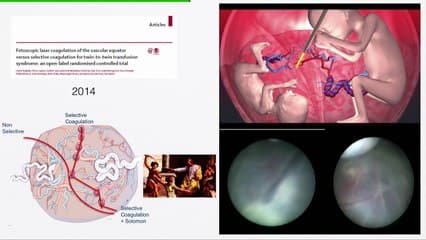 Les 10 publications marquantes en médecine fœtale (hors imagerie)