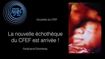 Echothèque : base de données et Intelligence Artificielle