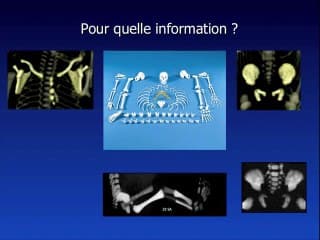 Scanner foetal : état de l'art