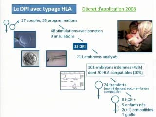 Diagnostic préimplantatoire ou diagnostic prénatal ?