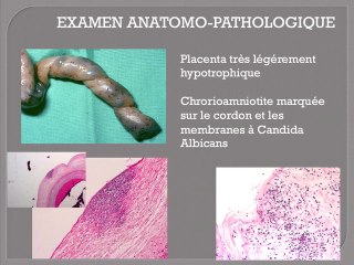 Quand la physiologie de la grossesse devient une situation à risque