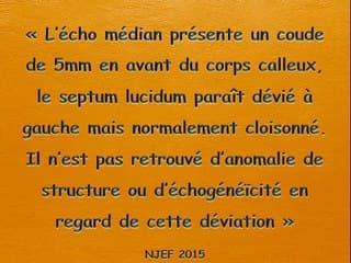 Anomalie de la ligne médiane cerveau