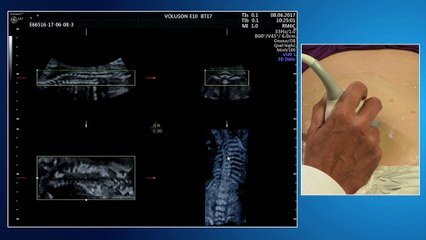 Recommandations CNEOF 2016 : les inchangés et les nouveautés Live en parallèle : comment examiner le thorax