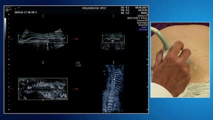 Recommandations CNEOF 2016 : les inchangés et les nouveautés Live en parallèle : comment examiner le thorax
