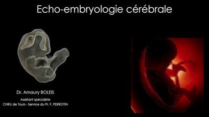 Echo-embryologie cérébrale