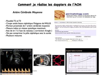 POSTER Doppler ACM