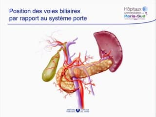 Les kystes de la région hépatique : comment s’y retrouver ?