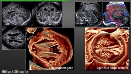 L’imagerie échographique 3D