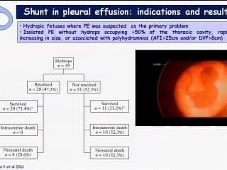 poumon foetal  ( en ANGLAIS )