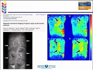 l' avenir de l' IRM foetale  ( en ANGLAIS )