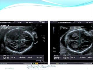 Le facteur sonne toujours 2 fois