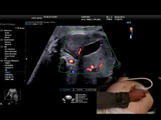 Démonstration live : Examiner les surrénales