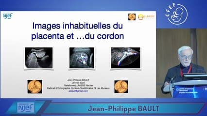 Images inhabituelles du placenta