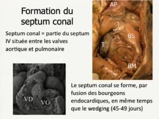 Embryologie du cœur normal