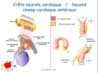 Coeur foetal - Les pathologies cono-troncales  Embryologie