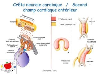 Coeur foetal - Les pathologies cono-troncales  Embryologie