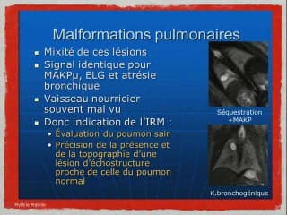 Quelle imagerie pour quel diagnostic : échographie, IRM, scanner