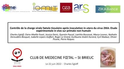 Fetal Zika virus inoculation in macaque revealed control of fetal viral load during pregnancy