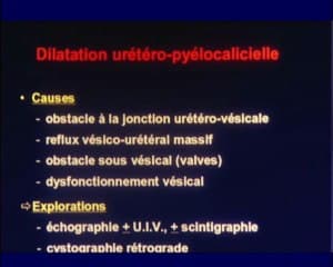Néphropédiatrie : l’accueil des nouveaux nés et leur suivi post natal