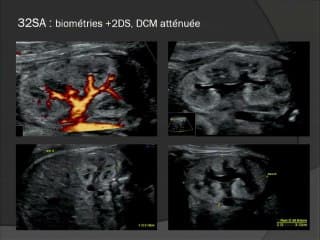 Quelques quizz en imagerie de l’appareil urinaire