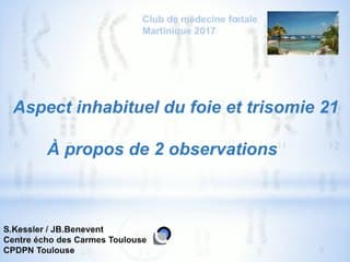 Aspect inhabituel du foie et trisomie 21 à propos de 2 observations.