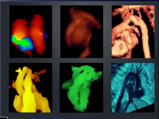 Echographie 3D : nouvelles imageries - applications actuelles et futures Quels outils ?