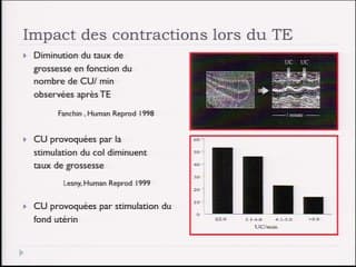 Espoir et désespoir des PMA Les riques de fausse-couche