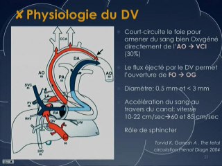 Grossesse gemellaire monochoriale biamniotique