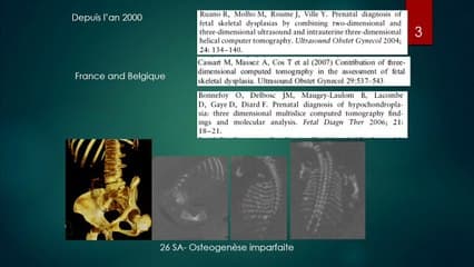 Morceaux choisis de pathologie squelettique foetale