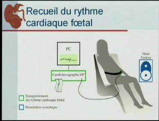 Développement de la sensorialité foetale : perception visuelle, auditive et vestibulaire.
