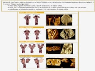 De la cartographie échographique au compte rendu normalisé