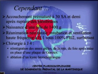 Hernie diaphragmatique