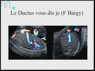 échographie du diaphragme