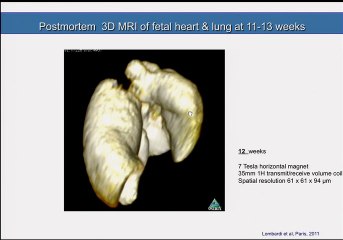 IRM post mortem  ( en ANGLAIS )