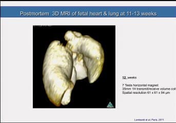 IRM post mortem  ( en ANGLAIS )