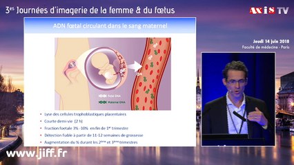 Problèmes éthiques posés par l’extension du DPNI au-delà de la trisomie 21